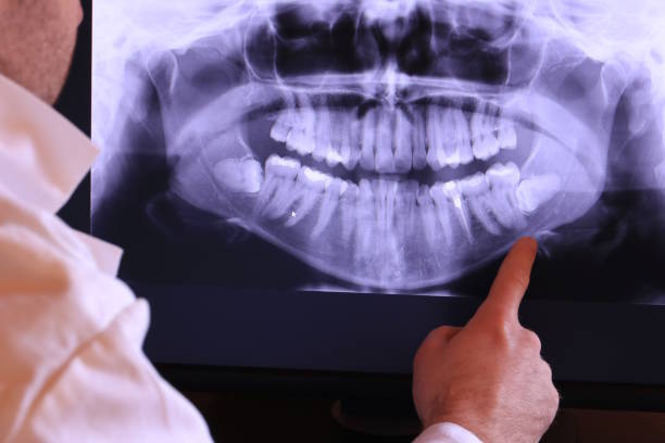 Best 24-Hour Emergency Dentist in New Paleste, IN